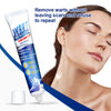 Blemish Removal Gel